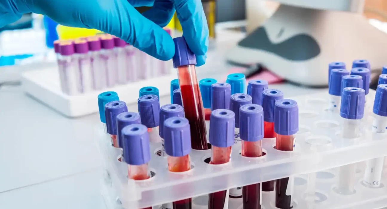 hematologia